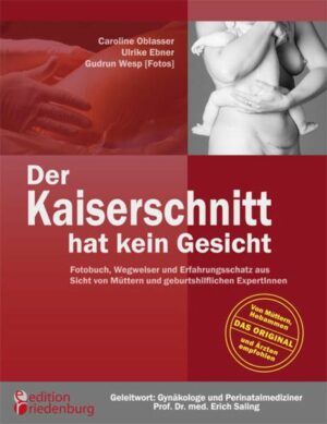 Der Kaiserschnitt hat kein Gesicht – Fotobuch, Wegweiser und Erfahrungsschatz aus Sicht von Müttern und geburtshilflichen ExpertInnen