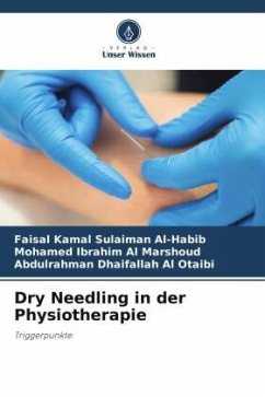 Dry Needling in der Physiotherapie