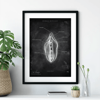 Animus Medicus Vulva Anatomie Poster – Chalkboard – A1