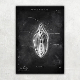 Animus Medicus Vulva Anatomie Poster – Chalkboard – A1