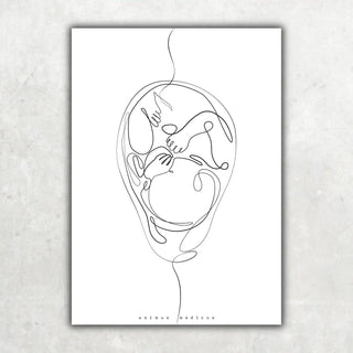 Animus Medicus Fetus Anatomie Minimalist – A1