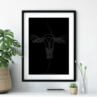 Animus Medicus Uterus Anatomie Minimalist Dark – A3