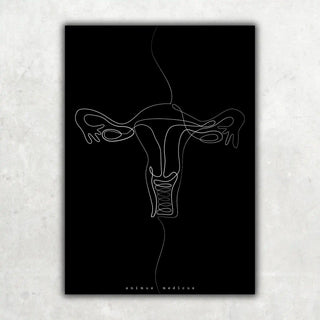 Animus Medicus Uterus Anatomie Minimalist Dark – A3