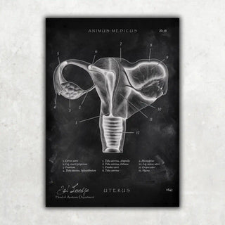 Animus Medicus Uterus mit Adnexe – Chalkboard – A1