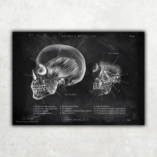 Animus Medicus Kaumuskulatur Anatomie – Chalkboard – A1