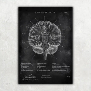 Animus Medicus Gehirn Aufbau im Schnitt – Chalkboard – A1