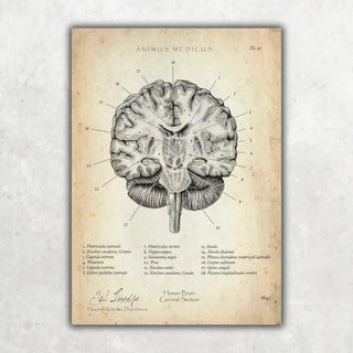 Animus Medicus Gehirn Aufbau im Schnitt – A1