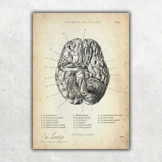 Circulus arteriosus willisii - A1 Animus Medicus