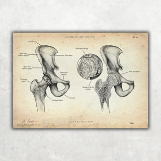 Animus Medicus Hüftarthrose – A1