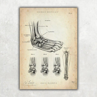Animus Medicus Sprunggelenk mit Bänderriss – A1