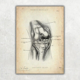 Animus Medicus Unhappy Triad Knie – A1