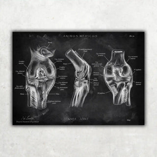 Animus Medicus Kniegelenk Anatomie – Chalkboard – A1