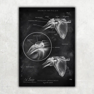 Animus Medicus Schulter Impingement – Chalkboard – A1