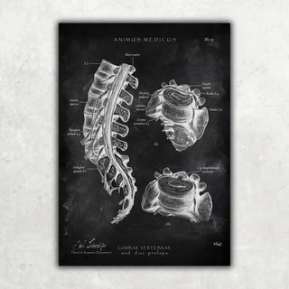 Animus Medicus Bandscheibenvorfall Anatomie – Chalkboard – A1