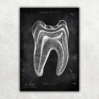 Animus Medicus Zahn Anatomie im Querschnitt – Chalkboard – A3