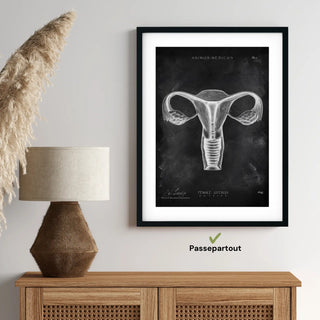 Animus Medicus Uterus Anatomie – Chalkboard – A1