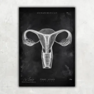 Animus Medicus Uterus Anatomie – Chalkboard – A5