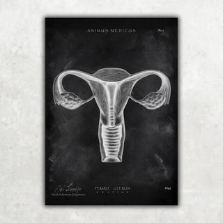 Animus Medicus Uterus Anatomie – Chalkboard – A1