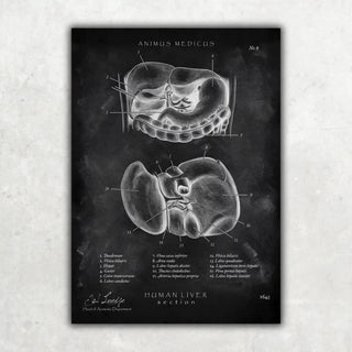 Animus Medicus Leber Anatomie – Chalkboard – A1