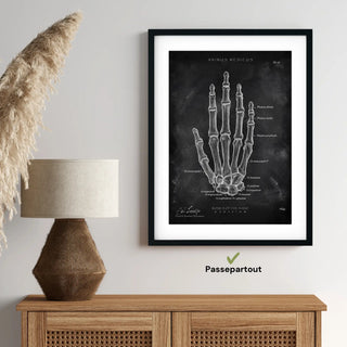 Animus Medicus Handknochen Anatomie – Chalkboard – A1