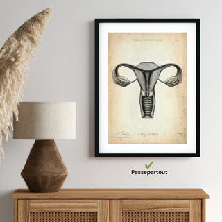 Animus Medicus Uterus Anatomie – A1