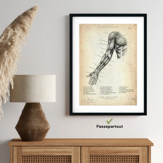 Animus Medicus Arm Anatomie ventral – A1