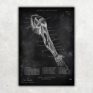 Arm Anatomie dorsal - Chalkboard - A1 Animus Medicus