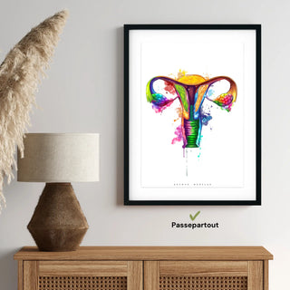 Animus Medicus Uterus Anatomie – Rainbow – A1